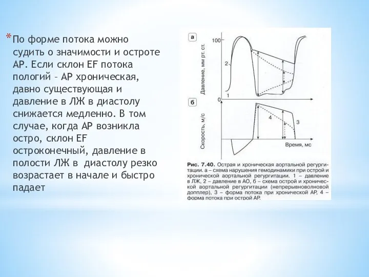 По форме потока можно судить о значимости и остроте АР. Если склон