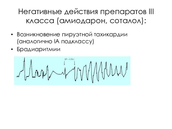 Негативные действия препаратов III класса (амиодарон, соталол): Возникновение пируэтной тахикардии (аналогично IА подклассу) Брадиаритмии