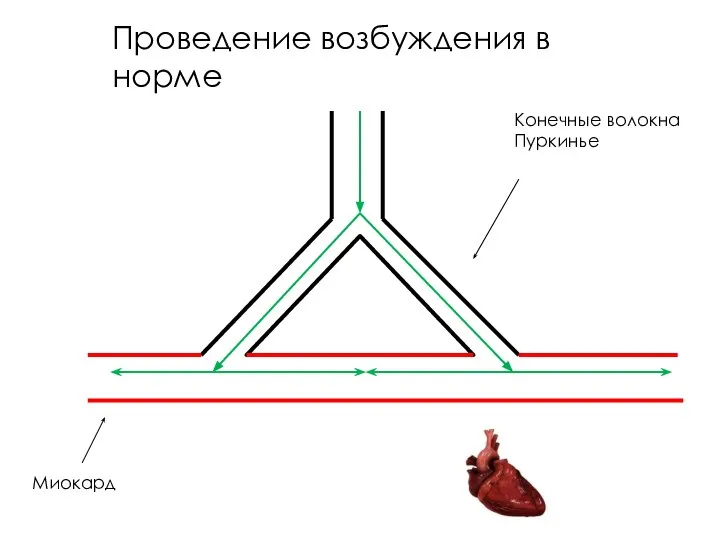 Проведение возбуждения в норме Конечные волокна Пуркинье Миокард