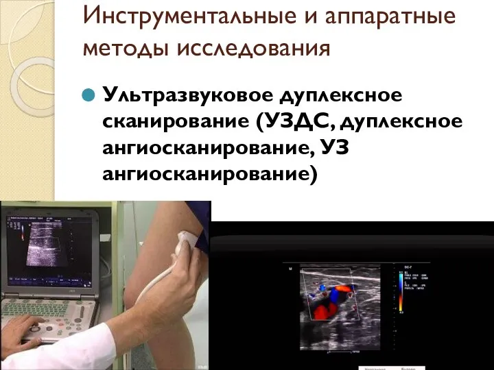 Инструментальные и аппаратные методы исследования Ультразвуковое дуплексное сканирование (УЗДС, дуплексное ангиосканирование, УЗ ангиосканирование)