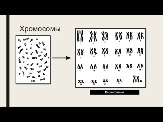 Хромосомы Кариограмма