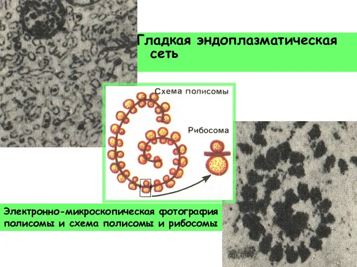 Гладкая эндоплазматическая сеть Электронно-микроскопическая фотография полисомы и схема полисомы и рибосомы
