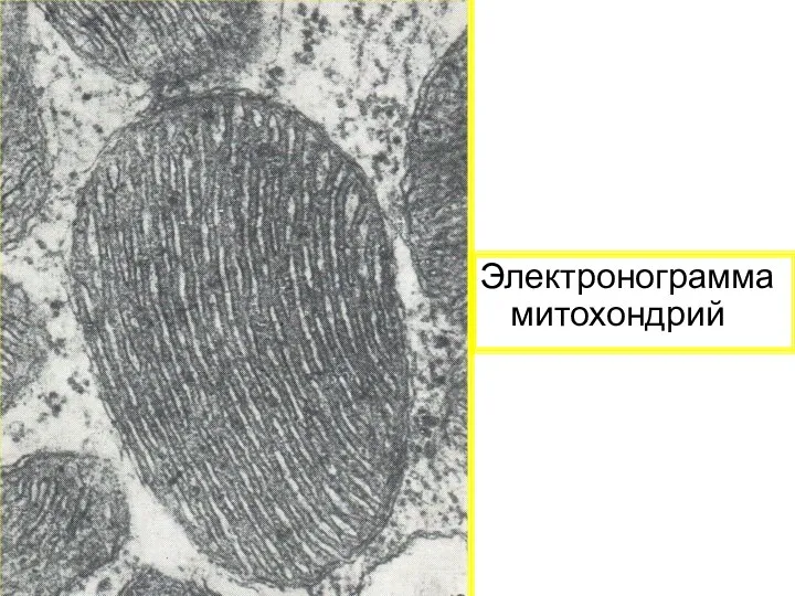Электронограмма митохондрий
