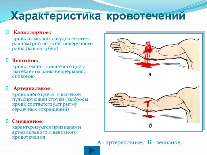 Характеристика кровотечений Капиллярное : кровь из мелких сосудов сочится равномерно по всей