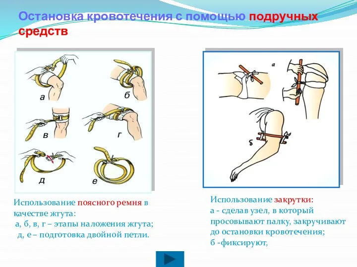 Остановка кровотечения с помощью подручных средств Использование поясного ремня в качестве жгута: