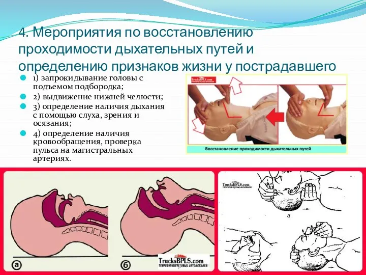 4. Мероприятия по восстановлению проходимости дыхательных путей и определению признаков жизни у