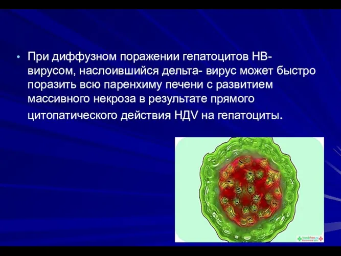 При диффузном поражении гепатоцитов НВ- вирусом, наслоившийся дельта- вирус может быстро поразить