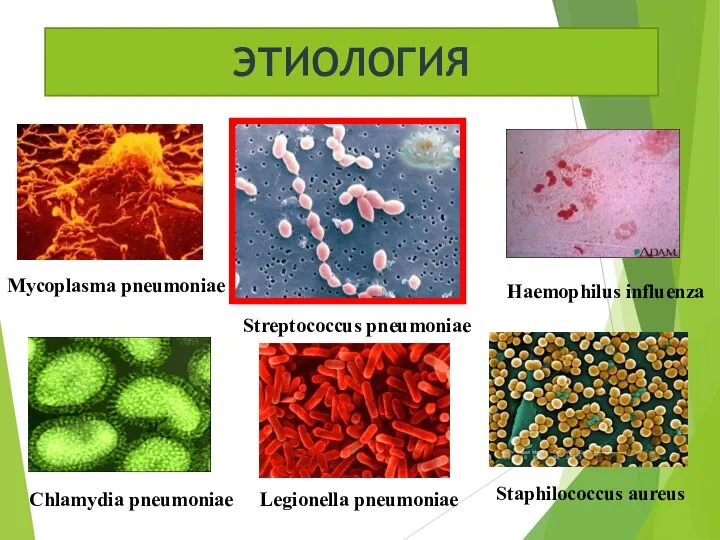 ЭТИОЛОГИЯ Mycoplasma pneumoniae Streptococcus pneumoniae Haemophilus influenza Chlamydia pneumoniae Legionella pneumoniae Staphilococcus aureus