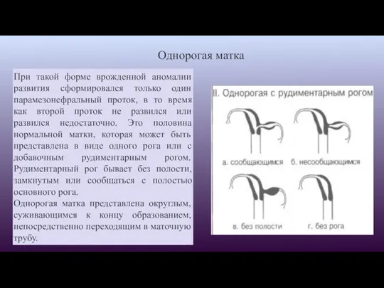 Однорогая матка При такой форме врожденной аномалии развития сформировался только один парамезонефральный