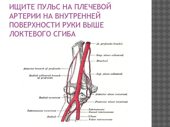 ИЩИТЕ ПУЛЬС НА ПЛЕЧЕВОЙ АРТЕРИИ НА ВНУТРЕННЕЙ ПОВЕРХНОСТИ РУКИ ВЫШЕ ЛОКТЕВОГО СГИБА