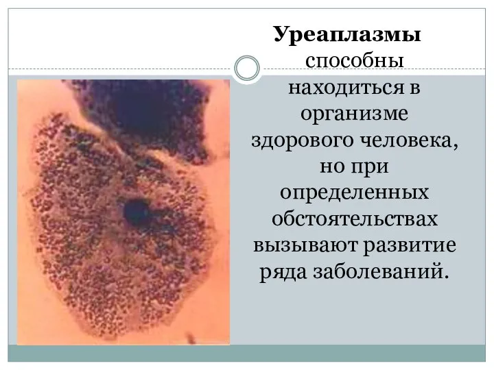 Уреаплазмы способны находиться в организме здорового человека, но при определенных обстоятельствах вызывают развитие ряда заболеваний.