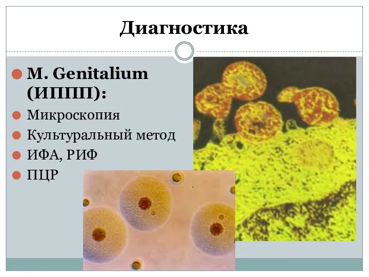 Диагностика M. Genitalium (ИППП): Микроскопия Культуральный метод ИФА, РИФ ПЦР