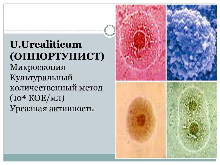 U.Urealiticum (ОППОРТУНИСТ) Микроскопия Культуральный количественный метод (10⁴ КОЕ/мл) Уреазная активность