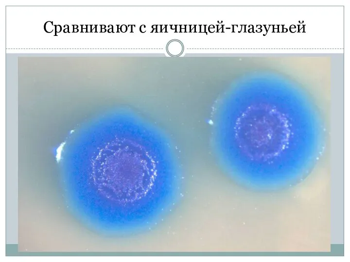 Сравнивают с яичницей-глазуньей