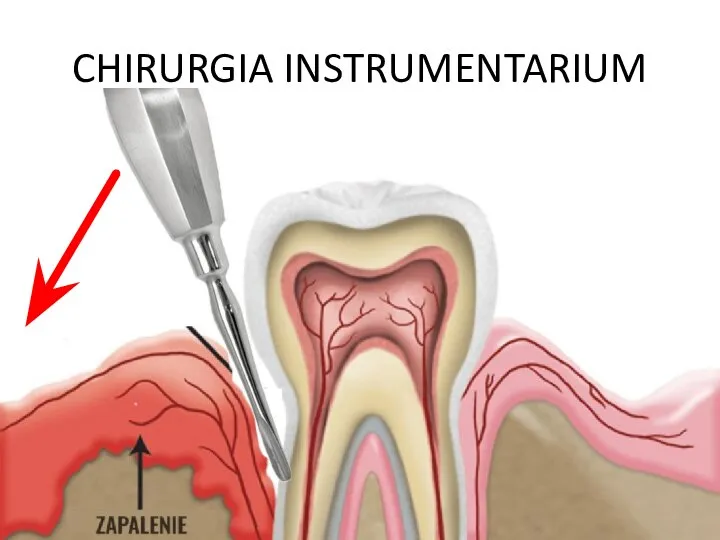 CHIRURGIA INSTRUMENTARIUM