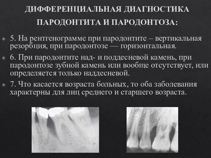 ДИФФЕРЕНЦИАЛЬНАЯ ДИАГНОСТИКА ПАРОДОНТИТА И ПАРОДОНТОЗА: 5. На рентгенограмме при пародонтите – вертикальная