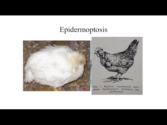 Epidermoptosis