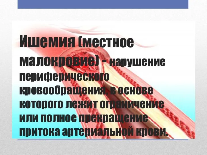 Ишемия (местное малокровие) - нарушение периферического кровообращения, в основе которого лежит ограничение