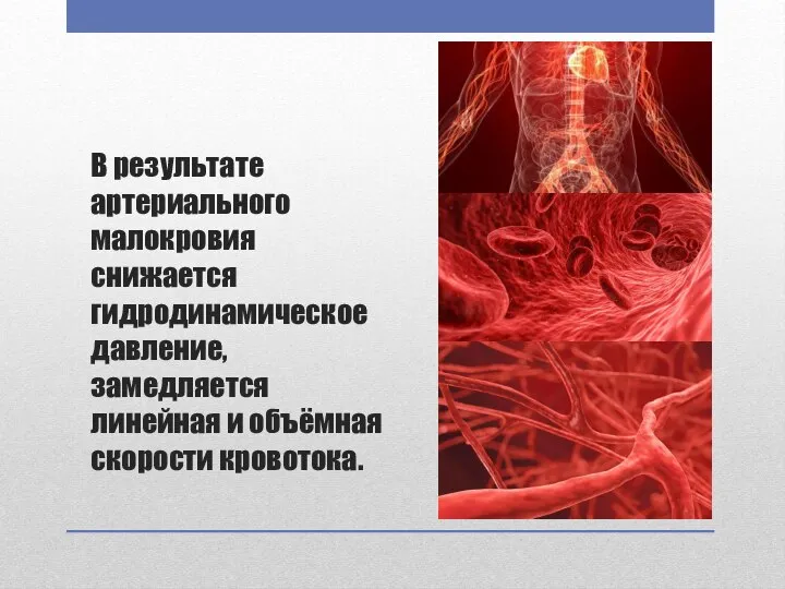 В результате артериального малокровия снижается гидродинамическое давление, замедляется линейная и объёмная скорости кровотока.