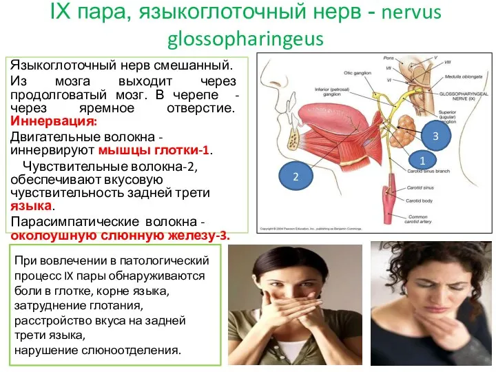 IX пара, языкоглоточный нерв - nervus glossopharingeus Языкоглоточный нерв смешанный. Из мозга