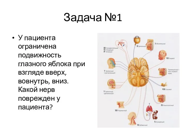 Задача №1 У пациента ограничена подвижность глазного яблока при взгляде вверх, вовнутрь,