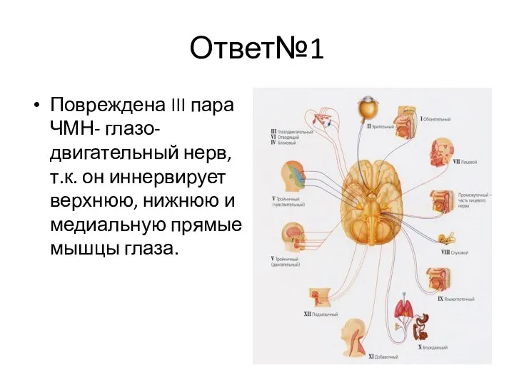 Ответ№1 Повреждена III пара ЧМН- глазо-двигательный нерв, т.к. он иннервирует верхнюю, нижнюю