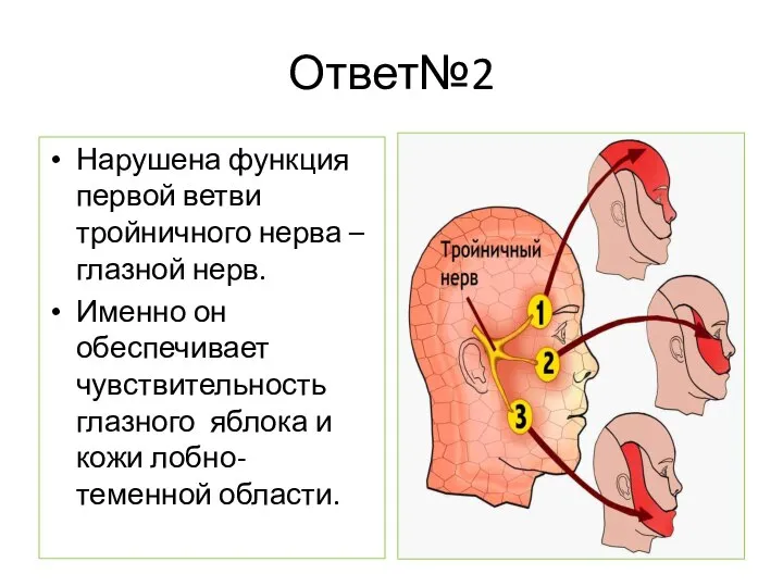 Ответ№2 Нарушена функция первой ветви тройничного нерва – глазной нерв. Именно он