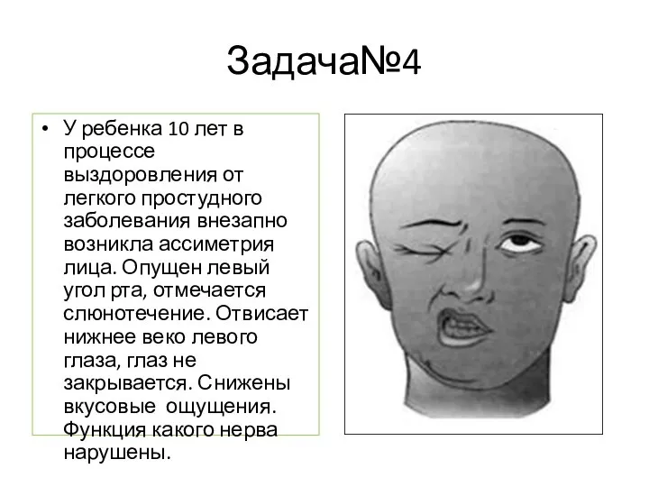 Задача№4 У ребенка 10 лет в процессе выздоровления от легкого простудного заболевания