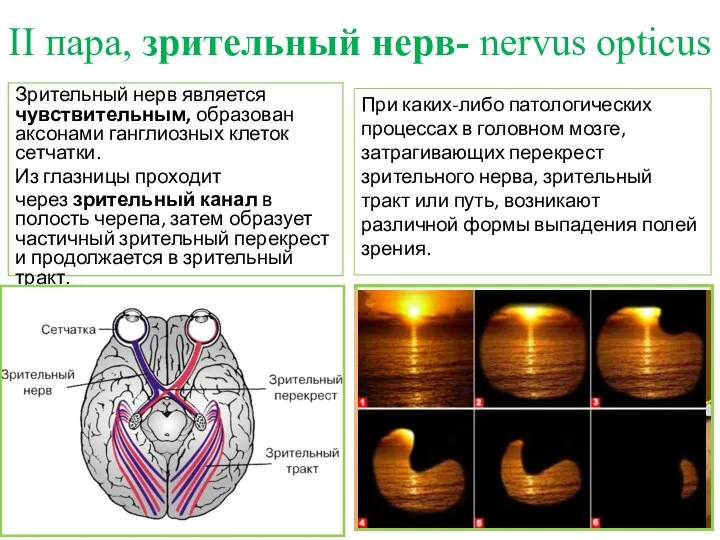 II пара, зрительный нерв- nervus opticus Зрительный нерв является чувствительным, образован аксонами