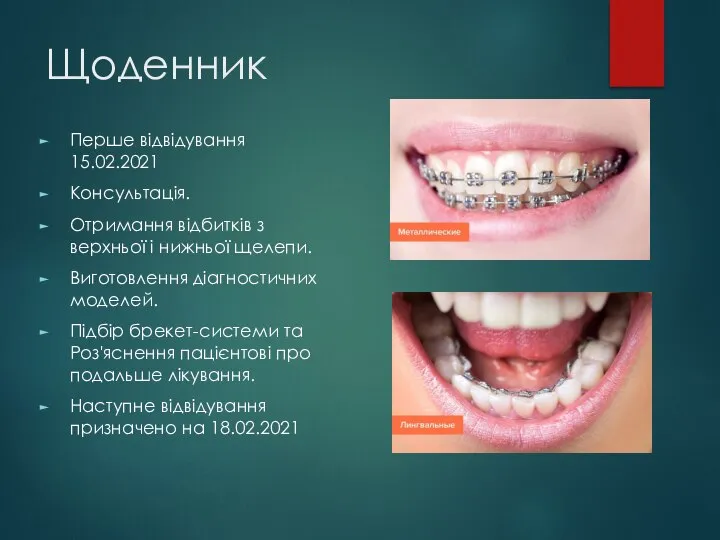 Щоденник Перше відвідування 15.02.2021 Консультація. Отримання відбитків з верхньої і нижньої щелепи.