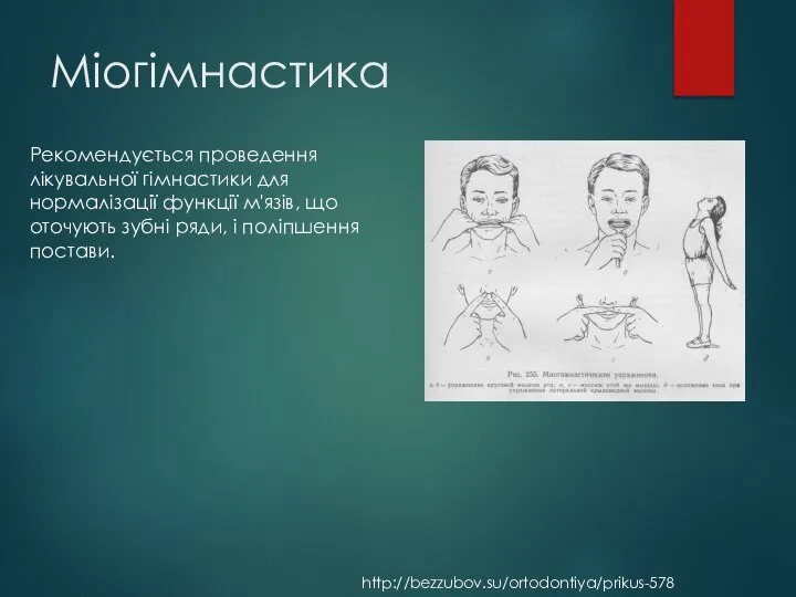 Міогімнастика Рекомендується проведення лікувальної гімнастики для нормалізації функції м'язів, що оточують зубні