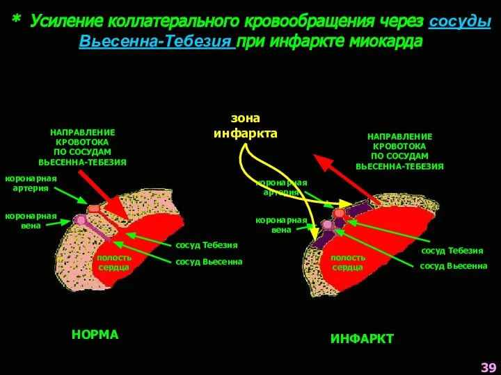 * Усиление коллатерального кровообращения через сосуды Вьесенна-Тебезия при инфаркте миокарда НОРМА НАПРАВЛЕНИЕ
