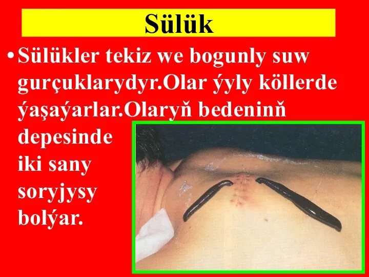 Sülük Sülükler tekiz we bogunly suw gurçuklarydyr.Olar ýyly köllerde ýaşaýarlar.Olaryň bedeninň depesinde