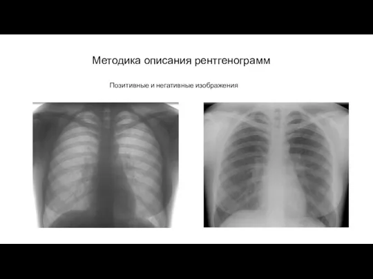 АКТУАЛЬНЫЕ ВОПРОСЫ РЕНТГЕНОЛОГИИ Методика описания рентгенограмм Позитивные и негативные изображения