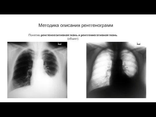 АКТУАЛЬНЫЕ ВОПРОСЫ РЕНТГЕНОЛОГИИ Методика описания рентгенограмм Понятие ренгтенпозитивная ткань и рентгеннегативная ткань (объект)