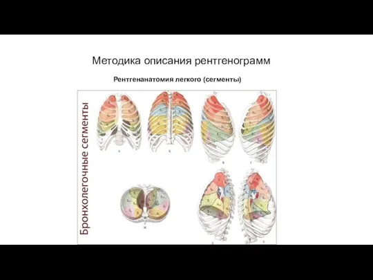 АКТУАЛЬНЫЕ ВОПРОСЫ РЕНТГЕНОЛОГИИ Методика описания рентгенограмм Рентгенанатомия легкого (сегменты)