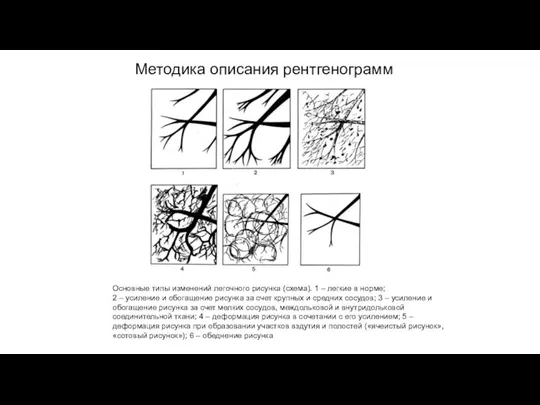 АКТУАЛЬНЫЕ ВОПРОСЫ РЕНТГЕНОЛОГИИ Методика описания рентгенограмм Анализ легочного рисунка Основные типы изменений