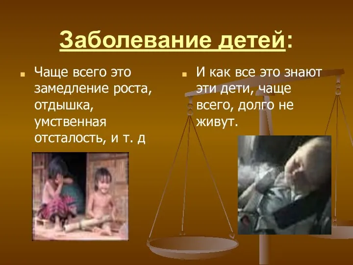 Заболевание детей: Чаще всего это замедление роста, отдышка, умственная отсталость, и т.