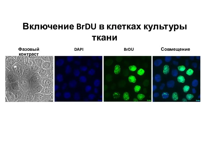 Фазовый контраст DAPI BrDU Совмещение Включение BrDU в клетках культуры ткани