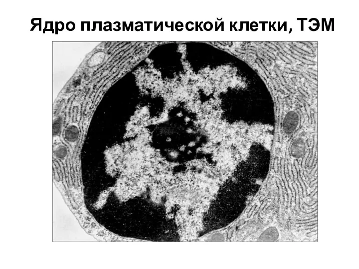 Ядро плазматической клетки, ТЭМ