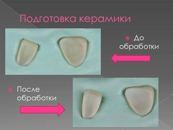 Подготовка керамики После обработки До обработки