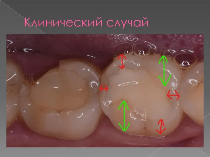 Клинический случай