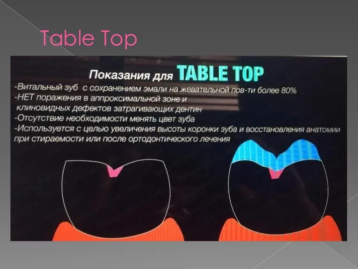 Table Top