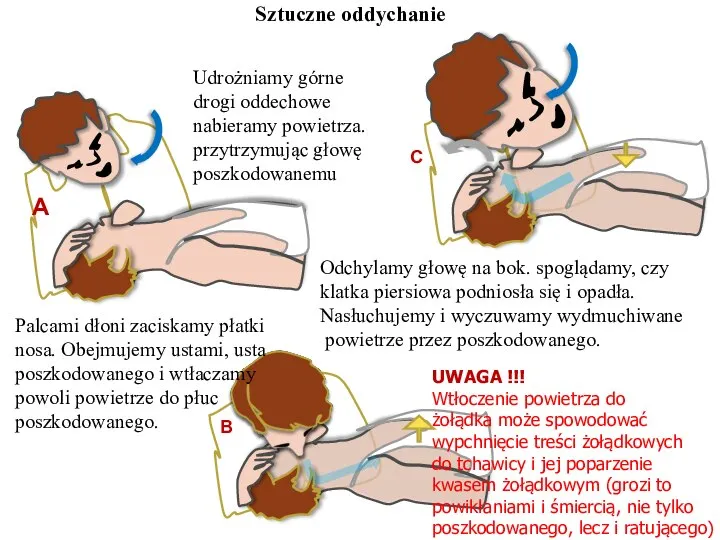 Sztuczne oddychanie B C Udrożniamy górne drogi oddechowe nabieramy powietrza. przytrzymując głowę