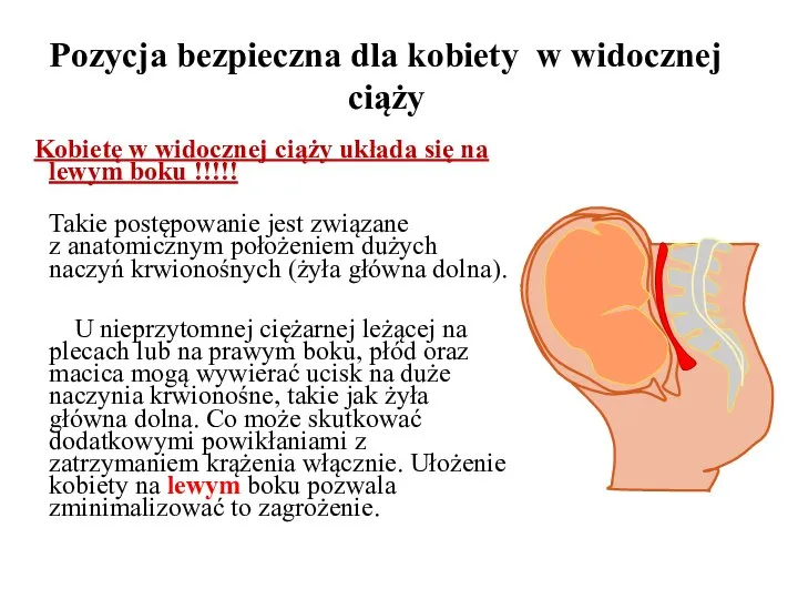 Kobietę w widocznej ciąży układa się na lewym boku !!!!! Takie postępowanie