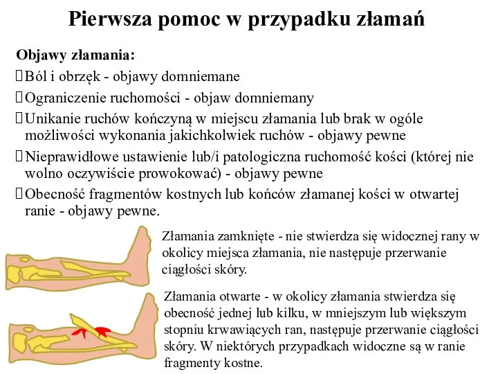 Objawy złamania: Ból i obrzęk - objawy domniemane Ograniczenie ruchomości - objaw