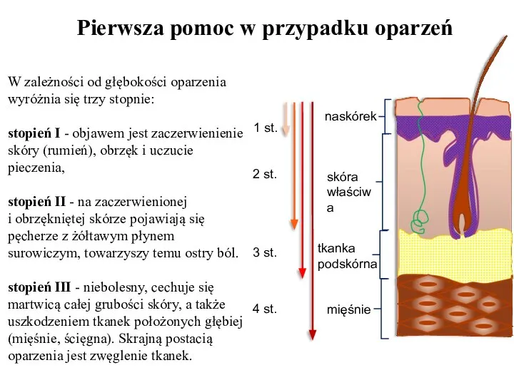 Pierwsza pomoc w przypadku oparzeń naskórek skóra właściwa tkanka podskórna mięśnie 2