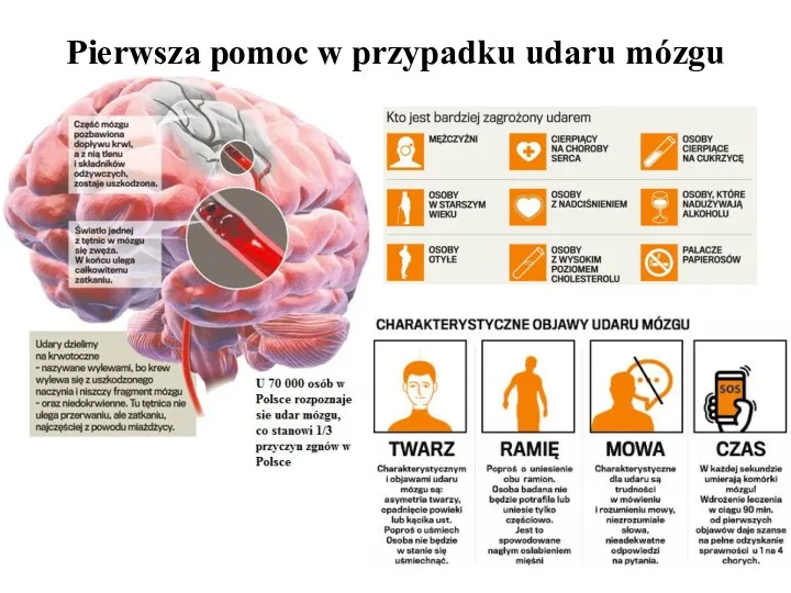 Pierwsza pomoc w przypadku udaru mózgu