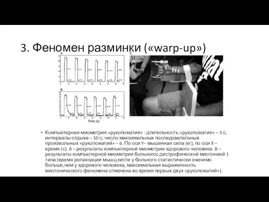 3. Феномен разминки («warp-up») Компьютерная миометрия «рукопожатия» : длительность «рукопожатия» – 3