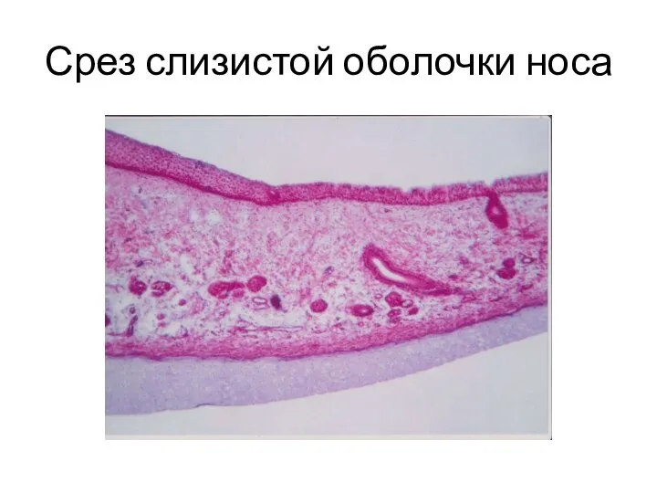 Срез слизистой оболочки носа